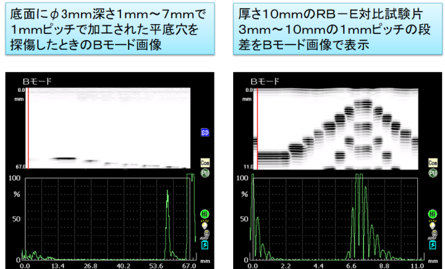 Bモード画像